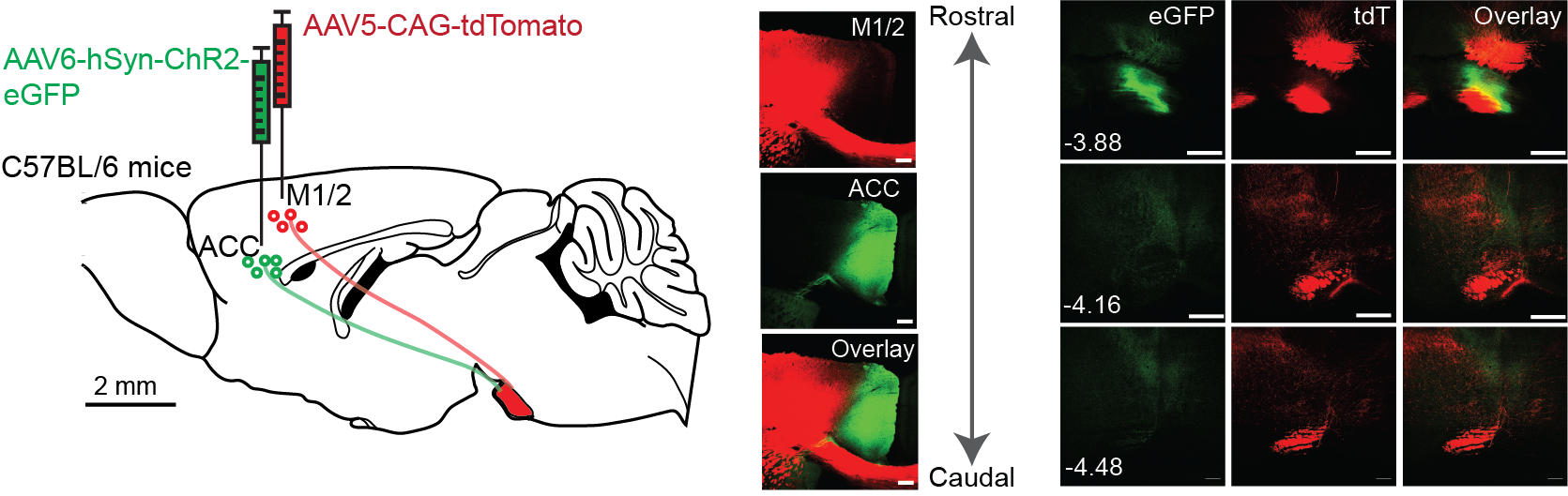 AAV-mediated anterograde tracing